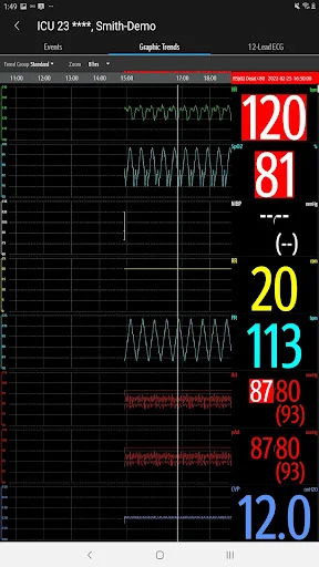 Mindray Mobile Viewer डाउनलोड करें – रीयल-टाइम पेशेंट मॉनिटरिंग - Screenshot 15